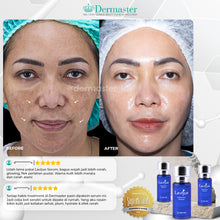 Load image into Gallery viewer, Dermaster Lavijue Serum & Clabiane Acu-Derm Cream